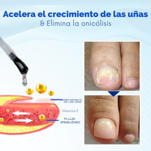 ONYXOGUARD | Uñas saludables