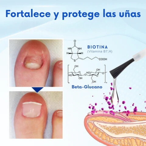 ONYXOGUARD | Uñas saludables