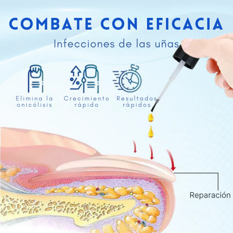 ONYXOGUARD | Uñas saludables